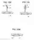 Fig. 13 - Method and devices for a sub-splenius/supra-levator scapulae surgical access technique