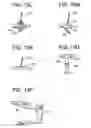 Fig. 16 - Method and devices for a sub-splenius/supra-levator scapulae surgical access technique