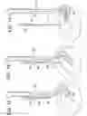 Fig. 18 - Method and devices for a sub-splenius/supra-levator scapulae surgical access technique