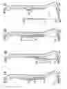 Fig. 19 - Method and devices for a sub-splenius/supra-levator scapulae surgical access technique