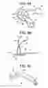 Fig. 07 - Method and Devices for a Sub-Splenius/Supra-Levator Scapulae Surgical Access Technique