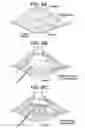 Fig. 09 - Method and Devices for a Sub-Splenius/Supra-Levator Scapulae Surgical Access Technique