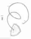 Fig. 02 - Method and Devices for a Sub-Splenius/Supra-Levator Scapulae Surgical Access Technique