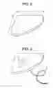 Fig. 03 - Method and Devices for a Sub-Splenius/Supra-Levator Scapulae Surgical Access Technique