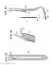 Fig. 23 - Method and Devices for a Sub-Splenius/Supra-Levator Scapulae Surgical Access Technique