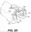 Fig. 06 - Instrument system for use with an interspinous implant