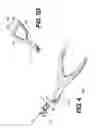Fig. 07 - Instrument system for use with an interspinous implant