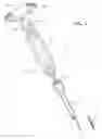 Fig. 02 - INSTRUMENT ASSEMBLY FOR USE WITH AN EXPANDABLE PEDICLE SCREW