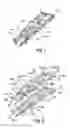 Fig. 02 - Split sternum prosthesis