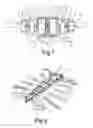 Fig. 05 - Split sternum prosthesis