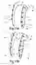 Fig. 07 - Split sternum prosthesis