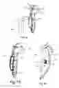 Fig. 09 - Split sternum prosthesis