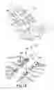 Fig. 10 - Split sternum prosthesis