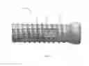 Fig. 07 - Expandable fastener for orthopaedic applications