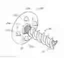 Fig. 01 - Method and apparatus for sacroiliac joint fixation