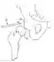 Fig. 01 - SURGICAL INSTRUMENT