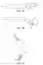Fig. 06 - SURGICAL INSTRUMENT
