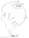 Fig. 09 - SURGICAL INSTRUMENT