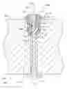 Fig. 07 - Apparatus, system, and method for crimping a cable for bone fixation
