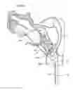 Fig. 01 - SYSTEMS, DEVICES, AND METHODS FOR OVARIAN DENERVATION