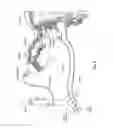 Fig. 06 - SYSTEMS, DEVICES, AND METHODS FOR OVARIAN DENERVATION