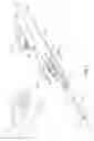 Fig. 02 - SHAPED ELECTRODE BIPOLAR RESECTION APPARATUS, SYSTEM AND METHODS OF USE
