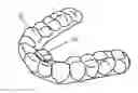 Fig. 01 - MULTIFUNCTIONAL INTELLIGENT INVISIBLE ORTHODONTIC BRACES AND MANUFACTURING METHOD THEREOF