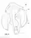 Fig. 06 - DENTAL IMPLANT METHOD AND APPARATUS