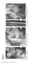 Fig. 09 - Method of endogenous stem cell activation for tendon/ligament osseointegration