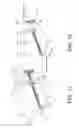 Fig. 06 - Ligament fixation system, implants, devices, and methods of use
