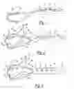 Fig. 02 - Method and apparatus for stitching tendons