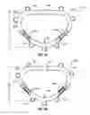 Fig. 05 - HEART AND PERIPHERAL VASCULAR VALVE REPLACEMENT IN CONJUNCTION WITH A SUPPORT RING