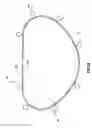 Fig. 07 - HEART AND PERIPHERAL VASCULAR VALVE REPLACEMENT IN CONJUNCTION WITH A SUPPORT RING