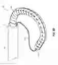 Fig. 19 - HEART AND PERIPHERAL VASCULAR VALVE REPLACEMENT IN CONJUNCTION WITH A SUPPORT RING