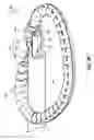 Fig. 20 - HEART AND PERIPHERAL VASCULAR VALVE REPLACEMENT IN CONJUNCTION WITH A SUPPORT RING