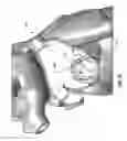 Fig. 22 - HEART AND PERIPHERAL VASCULAR VALVE REPLACEMENT IN CONJUNCTION WITH A SUPPORT RING