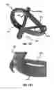 Fig. 31 - HEART AND PERIPHERAL VASCULAR VALVE REPLACEMENT IN CONJUNCTION WITH A SUPPORT RING