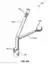 Fig. 34 - HEART AND PERIPHERAL VASCULAR VALVE REPLACEMENT IN CONJUNCTION WITH A SUPPORT RING