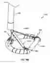 Fig. 35 - HEART AND PERIPHERAL VASCULAR VALVE REPLACEMENT IN CONJUNCTION WITH A SUPPORT RING