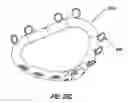 Fig. 47 - HEART AND PERIPHERAL VASCULAR VALVE REPLACEMENT IN CONJUNCTION WITH A SUPPORT RING