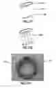 Fig. 49 - HEART AND PERIPHERAL VASCULAR VALVE REPLACEMENT IN CONJUNCTION WITH A SUPPORT RING