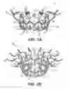 Fig. 02 - Prosthetic valve with inner and outer frames connected at a location of tissue anchor portion