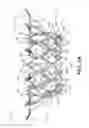 Fig. 03 - Prosthetic valve with inner and outer frames connected at a location of tissue anchor portion