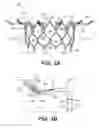 Fig. 06 - Prosthetic valve with inner and outer frames connected at a location of tissue anchor portion