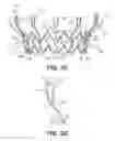 Fig. 07 - Prosthetic valve with inner and outer frames connected at a location of tissue anchor portion