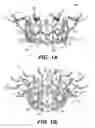 Fig. 02 - Prosthetic valve with connecting struts of variable size and tissue anchoring legs of variable size that extend from junctions