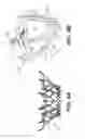 Fig. 08 - Prosthetic valve with inflatable cuff configured to fill a volume between atrial and ventricular tissue anchors