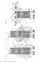 Fig. 09 - Prosthetic valve with inflatable cuff configured to fill a volume between atrial and ventricular tissue anchors