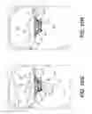 Fig. 22 - Prosthetic valve with inflatable cuff configured to fill a volume between atrial and ventricular tissue anchors