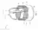 Fig. 02 - Replacement heart valve implant